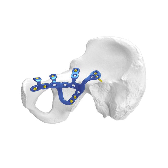 Anatomische Bekken-Acetabulum Vergrendelingsplaat