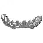 Titanium implantatenbrug