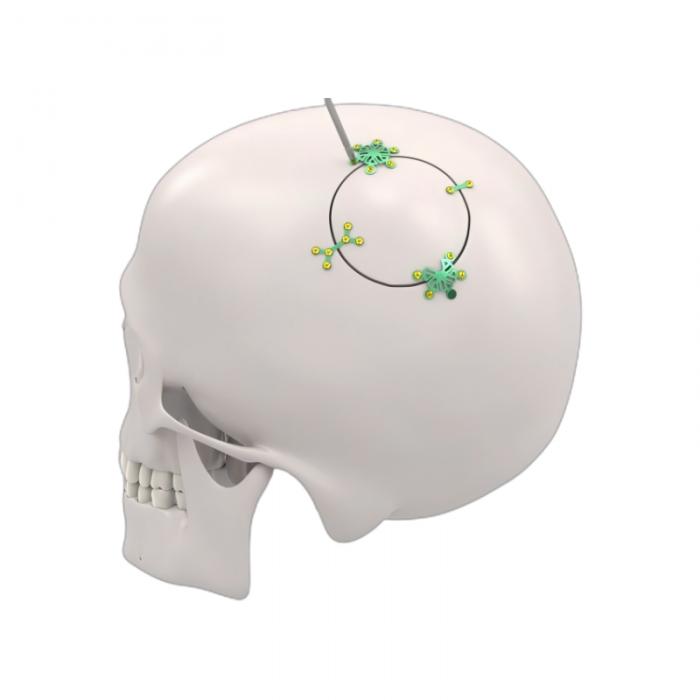 Cranio Fixatiesysteem